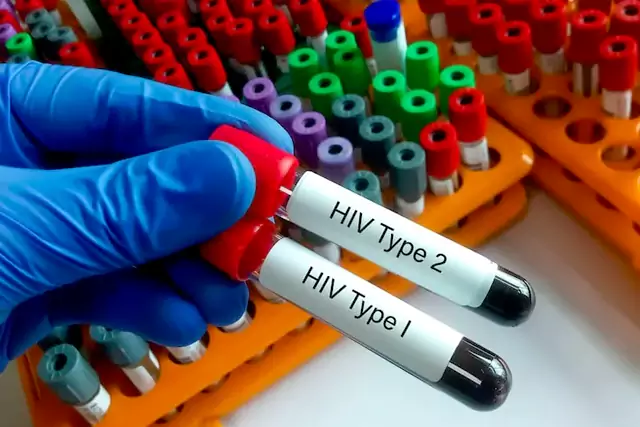 HIV Testing
